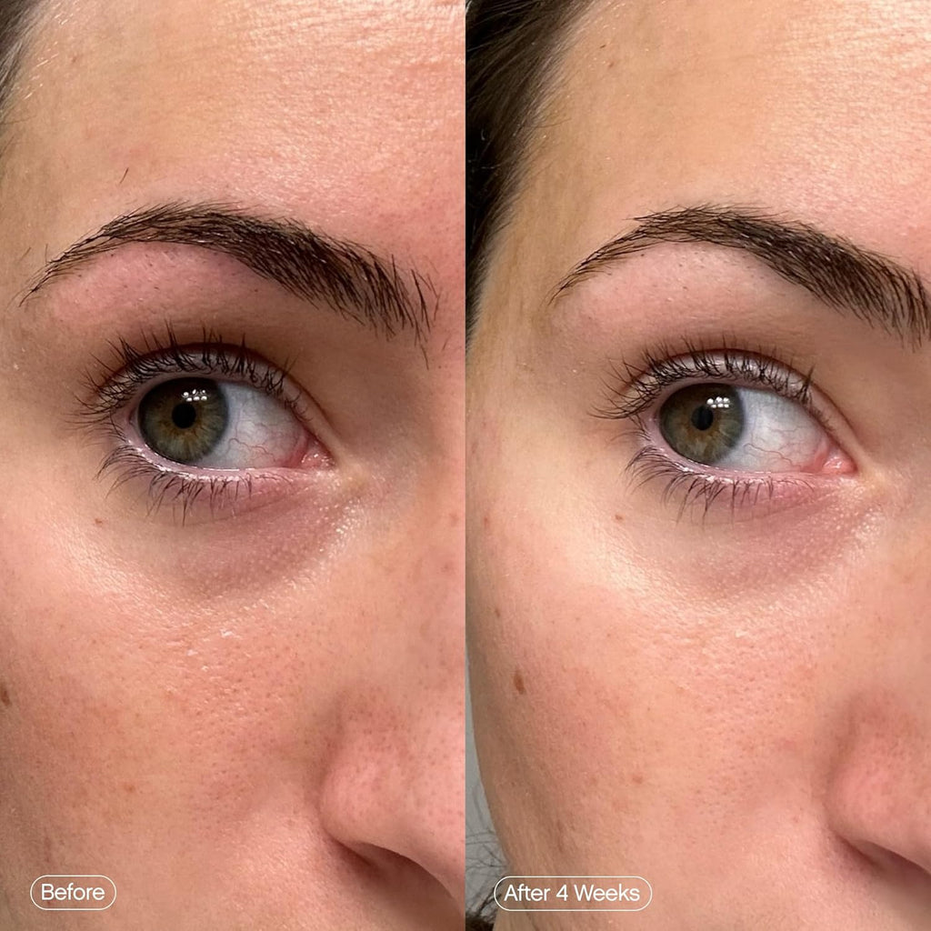 BrightLift Renew Under Eye Patches
