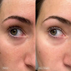 BrightLift Renew Under Eye Patches